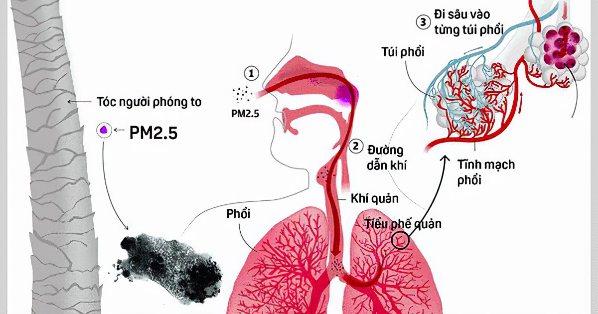 Tác hại của bụi mịn PM 2.5